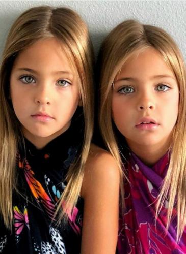 Son las gemelas más lindas del mundo y no vas a poder dejar de mirarlas
